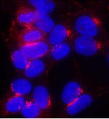 Immunocytochemistry/ Immunofluorescence: HA Tag Antibody [NB600-363]