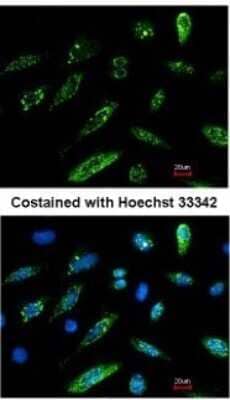 Immunocytochemistry/ Immunofluorescence: HA Tag Antibody [NBP2-21581]