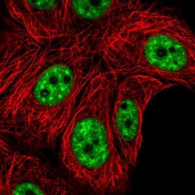 Immunocytochemistry/ Immunofluorescence: HA95/AKAP8L Antibody [NBP2-47440]