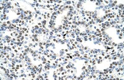 Immunohistochemistry: HA95/AKAP8L Antibody [NBP2-87550]