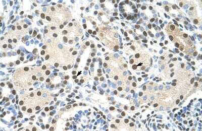 Immunohistochemistry: HA95/AKAP8L Antibody [NBP2-87550]
