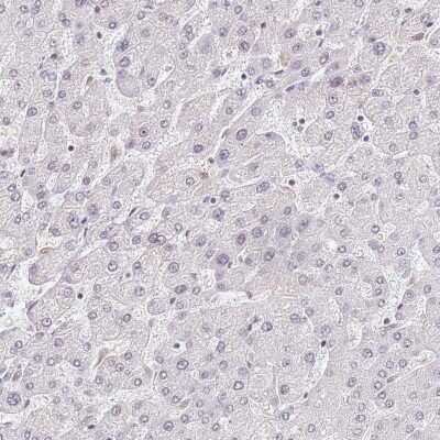 Immunohistochemistry-Paraffin: HA95/AKAP8L Antibody [NBP2-47440]