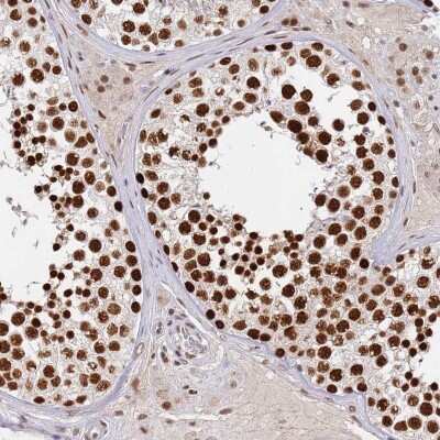 Immunohistochemistry-Paraffin: HA95/AKAP8L Antibody [NBP2-47440]