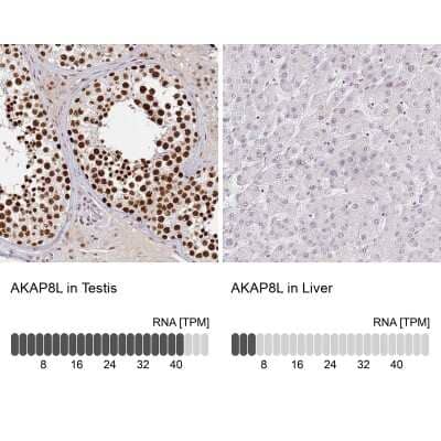 Immunohistochemistry-Paraffin: HA95/AKAP8L Antibody [NBP2-47440]