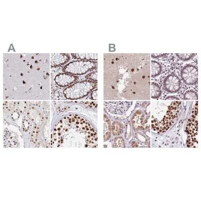Immunohistochemistry-Paraffin: HA95/AKAP8L Antibody [NBP2-47440]