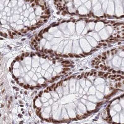 Immunohistochemistry-Paraffin: HA95/AKAP8L Antibody [NBP2-47440]