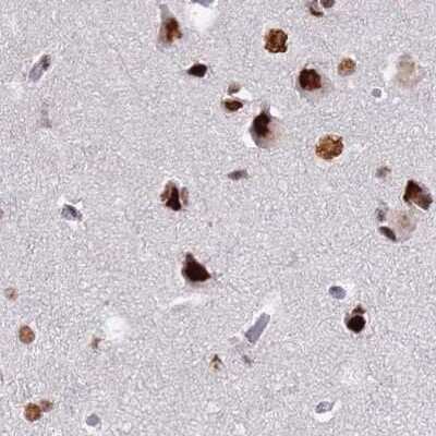 Immunohistochemistry-Paraffin: HA95/AKAP8L Antibody [NBP2-47440]