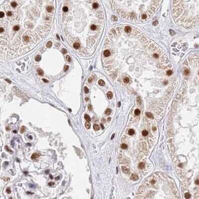 Immunohistochemistry-Paraffin: HA95/AKAP8L Antibody [NBP2-47440]