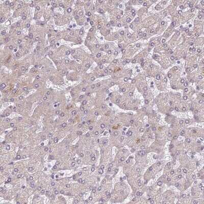 Immunohistochemistry-Paraffin: HA95/AKAP8L Antibody [NBP2-47441]