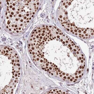 Immunohistochemistry-Paraffin: HA95/AKAP8L Antibody [NBP2-47441]