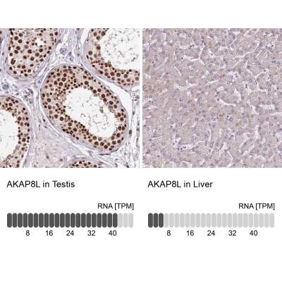 Immunohistochemistry-Paraffin: HA95/AKAP8L Antibody [NBP2-47441]