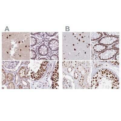 Immunohistochemistry-Paraffin: HA95/AKAP8L Antibody [NBP2-47441]