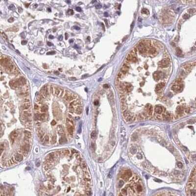 Immunohistochemistry-Paraffin: HA95/AKAP8L Antibody [NBP2-47441]