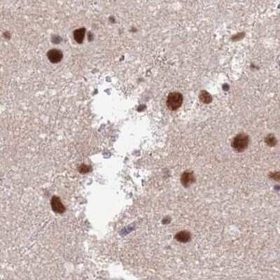 Immunohistochemistry-Paraffin: HA95/AKAP8L Antibody [NBP2-47441]