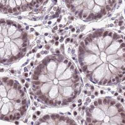 Immunohistochemistry-Paraffin: HA95/AKAP8L Antibody [NBP2-47441]