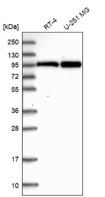 Western Blot: HA95/AKAP8L Antibody [NBP2-47440]
