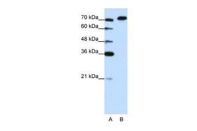 Western Blot: HA95/AKAP8L Antibody [NBP2-87550]