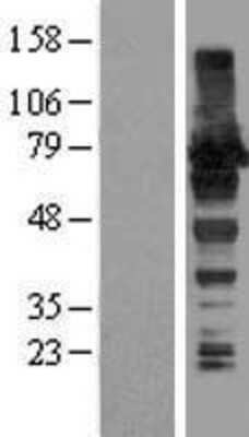 Western Blot: HA95/AKAP8L Overexpression Lysate [NBL1-07430]