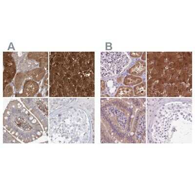 Immunohistochemistry-Paraffin: HAAO Antibody [NBP1-85892]