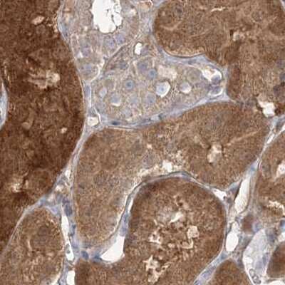 Immunohistochemistry-Paraffin: HAAO Antibody [NBP1-85892]