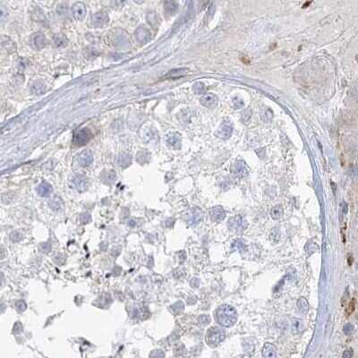 Immunohistochemistry-Paraffin: HAAO Antibody [NBP1-85892]