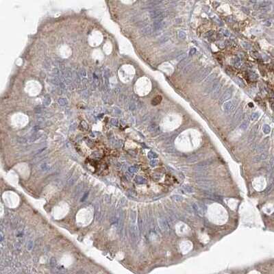 Immunohistochemistry-Paraffin: HAAO Antibody [NBP1-85892]