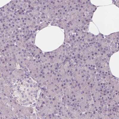 Immunohistochemistry-Paraffin: HAAO Antibody [NBP2-48755]