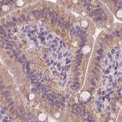 Immunohistochemistry-Paraffin: HAAO Antibody [NBP2-48755]