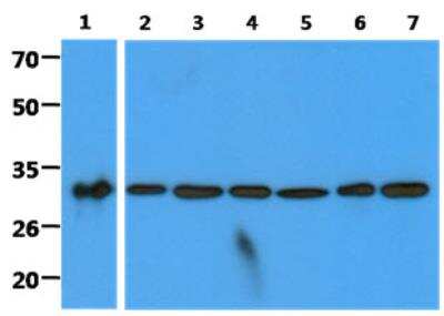 Western Blot: HABP1/C1QBP/GC1q R Antibody (1G7)BSA Free [NBP2-42691]