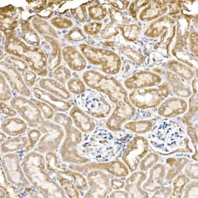 Immunohistochemistry-Paraffin: HABP1/C1QBP/GC1q R Antibody (6N7U3) [NBP3-15368]