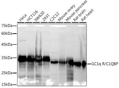 Western Blot: HABP1/C1QBP/GC1q R Antibody (6N7U3) [NBP3-15368]