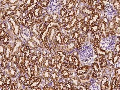 Immunohistochemistry-Paraffin: HABP1/C1QBP/GC1q R Antibody [NBP2-98236]