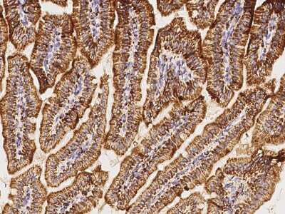 Immunohistochemistry-Paraffin: HABP1/C1QBP/GC1q R Antibody [NBP2-98236]