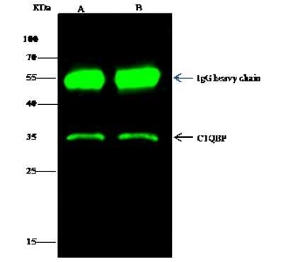 Immunoprecipitation: HABP1/C1QBP/GC1q R Antibody [NBP2-98235]