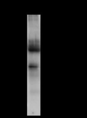 Immunoprecipitation: HABP1/C1QBP/GC1q R Antibody [NBP2-98236]