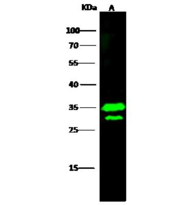 Western Blot: HABP1/C1QBP/GC1q R Antibody [NBP2-99898]