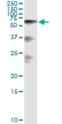 Immunoprecipitation: HABP2 Antibody (1H4) [H00003026-M01]