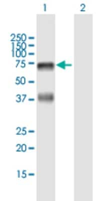 Western Blot: HABP2 Antibody [H00003026-B01P]