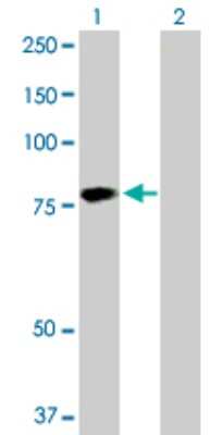 Western Blot: HABP2 Antibody [H00003026-D01P]