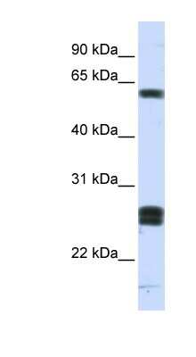 Western Blot: HABP2 Antibody [NBP1-59163]