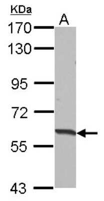 Western Blot: HABP2 Antibody [NBP2-16775]