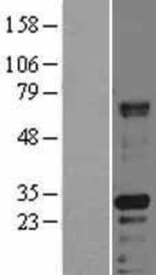 Western Blot: HABP2 Overexpression Lysate [NBL1-11432]