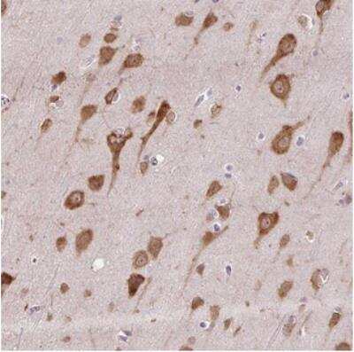 Immunohistochemistry: HABP4 Antibody [NBP2-30907]