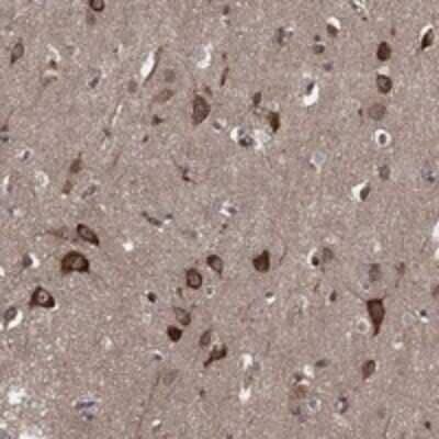 Immunohistochemistry-Paraffin: HABP4 Antibody [NBP3-17861]