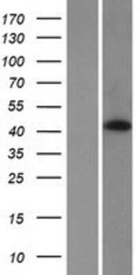 Western Blot: HABP4 Overexpression Lysate [NBP2-07362]