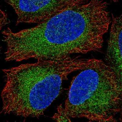 Immunocytochemistry/ Immunofluorescence: HACE1 Antibody [NBP2-58757]