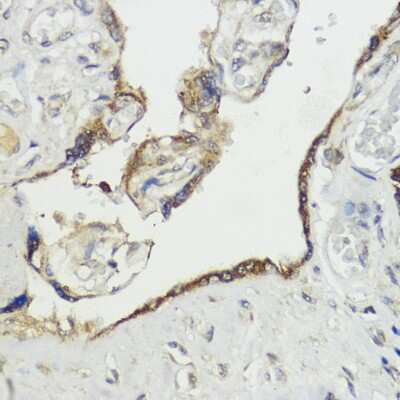 Immunohistochemistry-Paraffin: HACE1 Antibody - Azide and BSA Free [NBP3-03904]