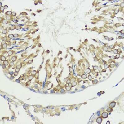 Immunohistochemistry-Paraffin: HACE1 Antibody - Azide and BSA Free [NBP3-03904]