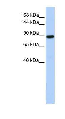 Western Blot: HACE1 Antibody [NBP1-55062]