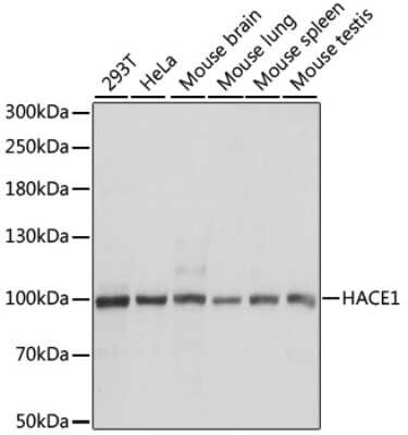 Western Blot: HACE1 AntibodyAzide and BSA Free [NBP3-03904]